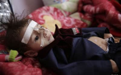 UNICEF žiada o pomoc pre Jemen, miliónom detí tam hrozí hlad.