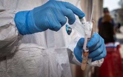 Slovensko zrejme čaká plošné testovanie na koronavírus, štát sa už pripravuje.