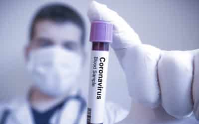 Změňme definici covidu, stanovme podmínky konce epidemie.“ Protilátky fungují, tvrdí česká studie.