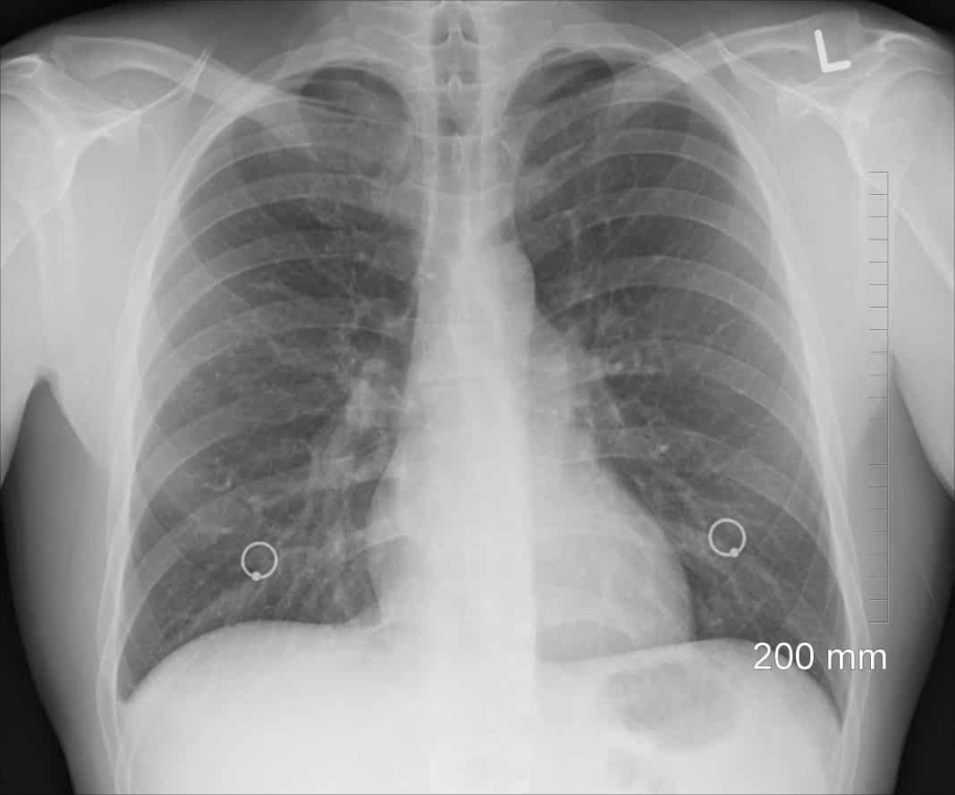 diagnosis-gd0cc0c60e-1920-1068×889